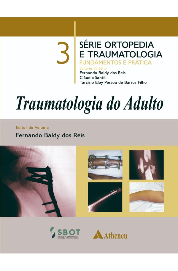 Mir hebe cock -2 f"  Traumatologia do Adulto - livrariaunesp