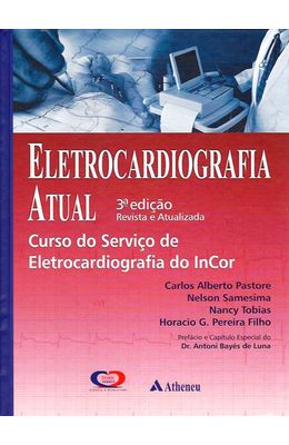 Eletrocardiografia-atual