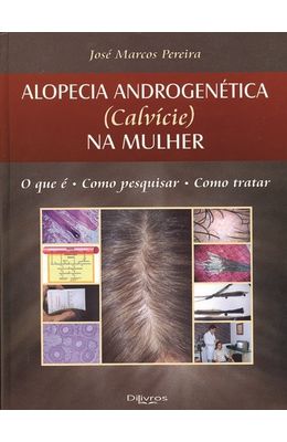 Alopecia-androgenetica--calvice--na-mulher