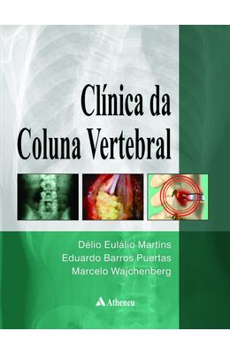 CL�NICA-DA-COLUNA-VERTEBRAL