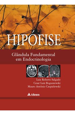 HIP�FISE---GL�NDULA-EM-ENDOCRINOLOGIA